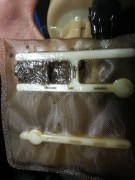 Dyzelinių kuro sistemų užterštumas